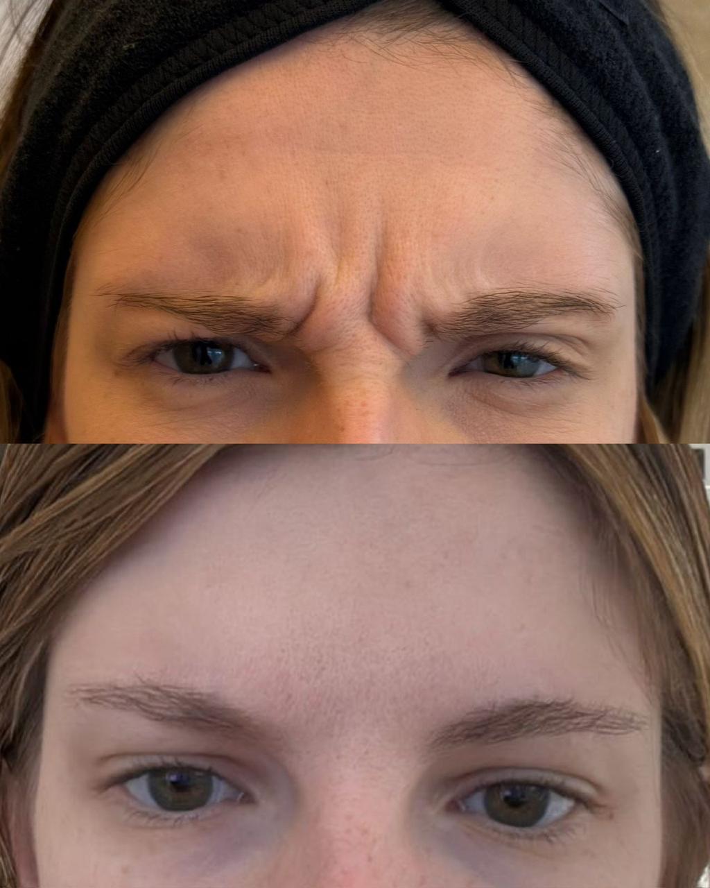 Registro antes e depois de tratamento estético